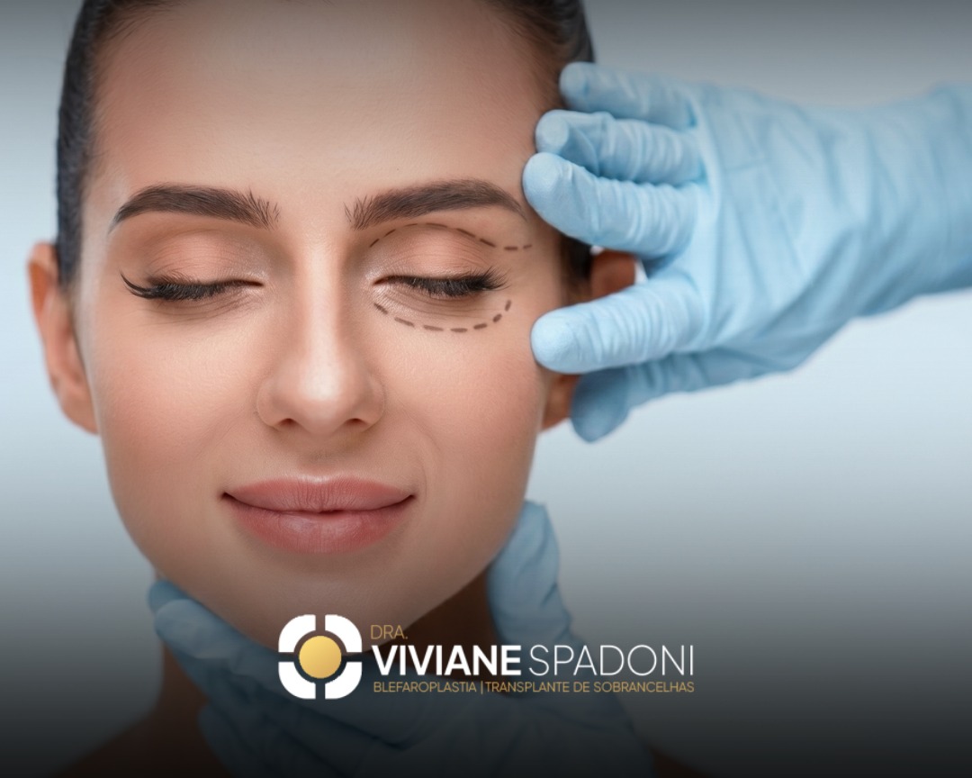 blefaroplastia cicatriz