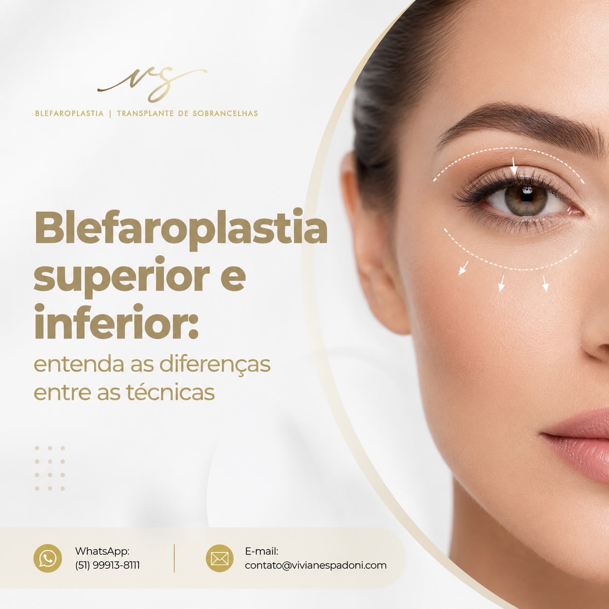 muitas pessoas têm dúvidas sobre a diferença entre a blefaroplastia superior e a blefaroplastia inferior e em quais situações cada técnica é indicada.