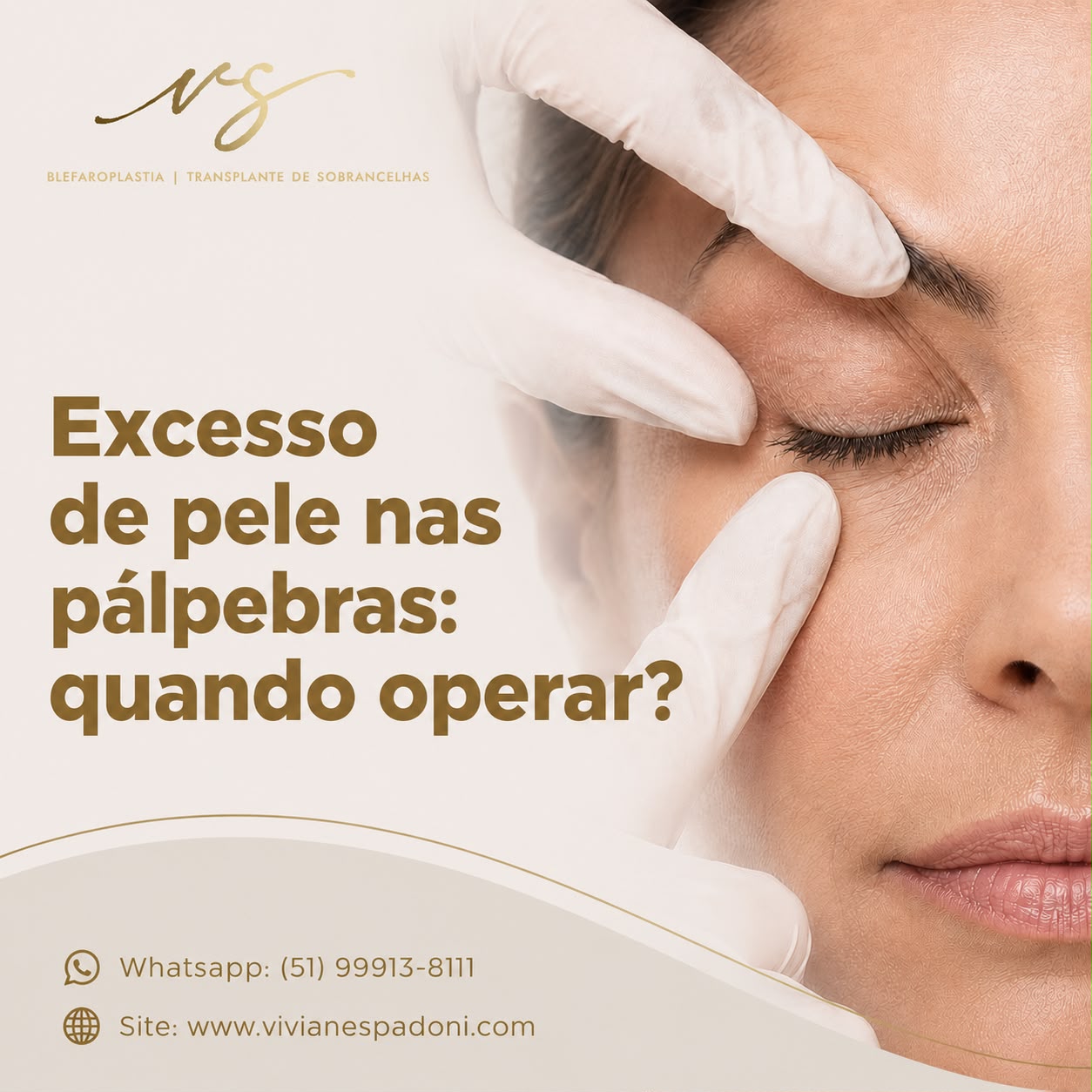 Saiba quando a flacidez nas pálpebras deixa de ser apenas uma questão estética e passa a comprometer sua qualidade de vida
