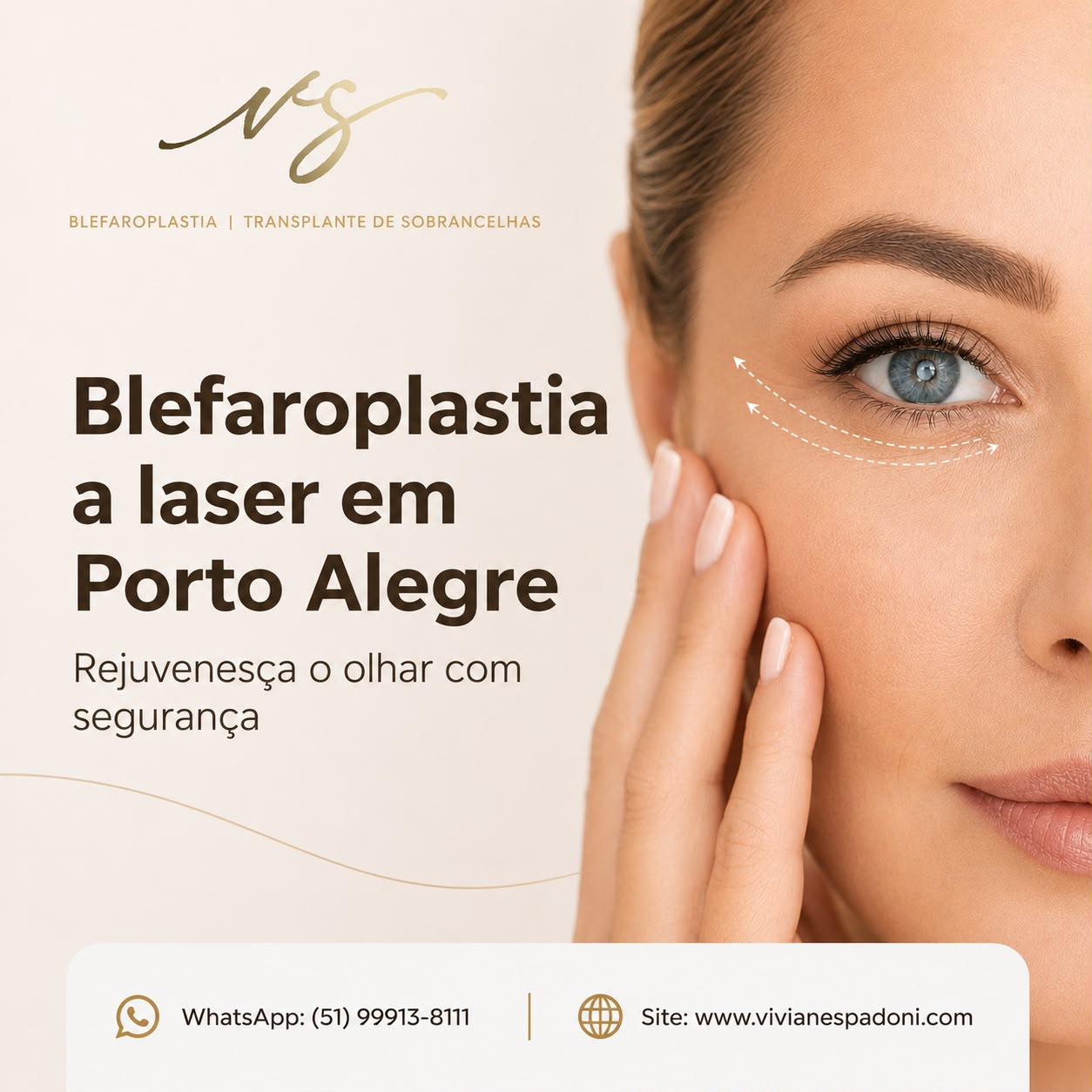 Entenda como o procedimento pode melhorar a aparência das pálpebras e saiba o que esperar antes, durante e após a cirurgia.