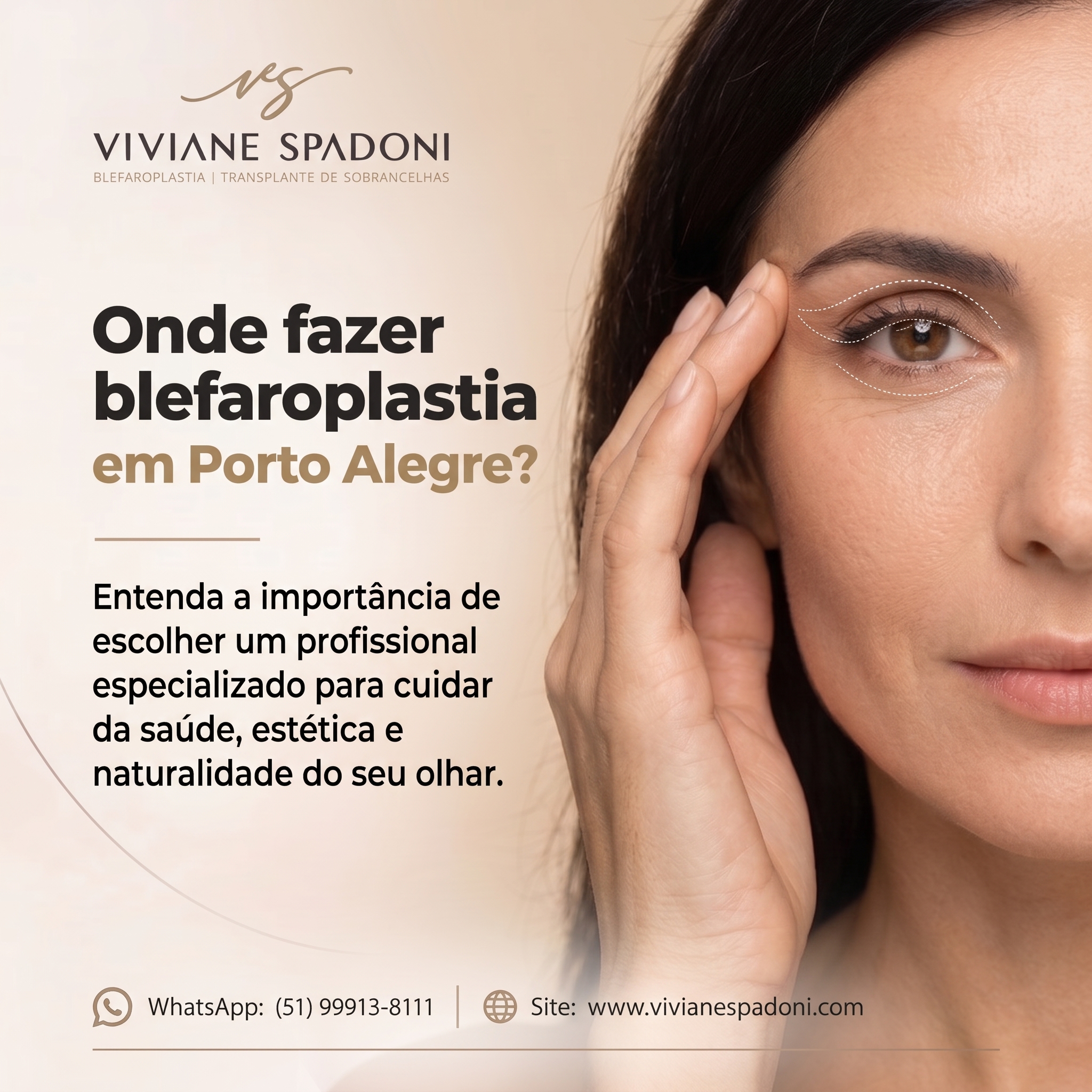 Blefaroplastia em Porto Alegre